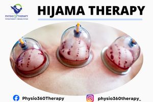 Hijama therapy treatment for detoxification, pain relief and improved blood circulation by expert therapist at Physio360 Therapy Delhi