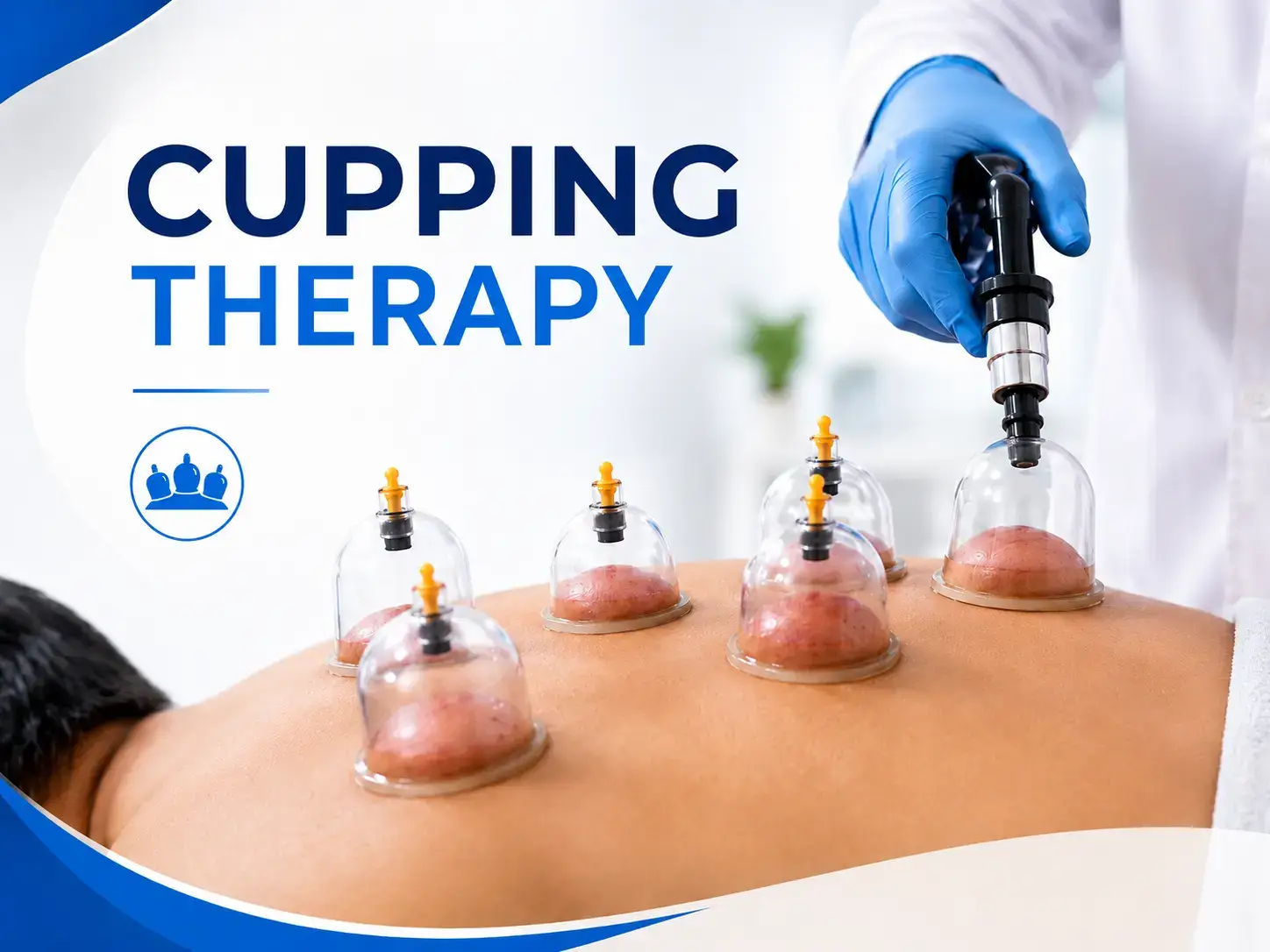 cupping-therapy-treatment.jpg
