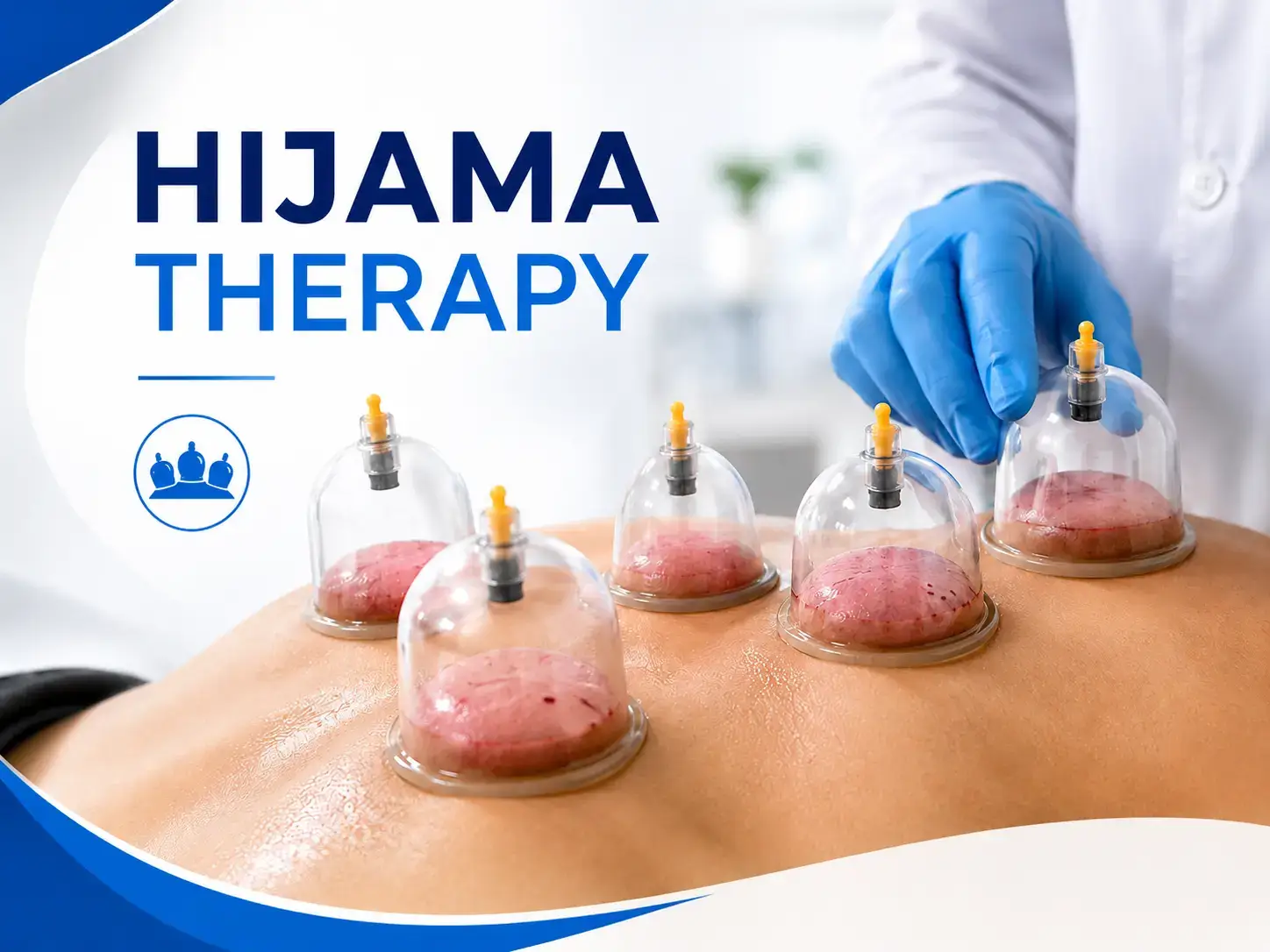 hijama-therapy-treatment.jpg