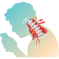 Neck Pain