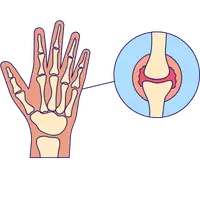Paralysis rehabilitation